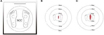 Association of Static Posturography With Severity of White Matter Hyperintensities